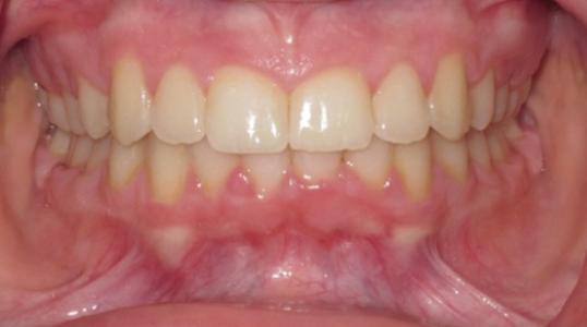 Case 1 After Picture