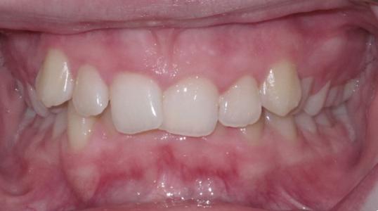 Case 1 Before Picture