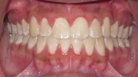 Case 2 After Picture