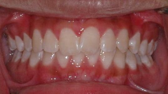 Case 2 Before Picture