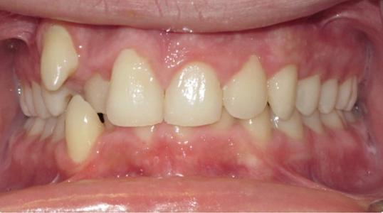 Case 3 Before Picture