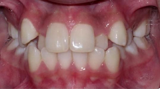 Case 6 Before Picture