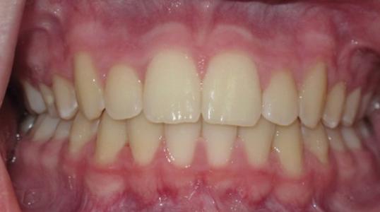 Case 7 After Picture