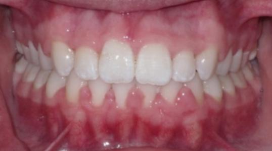 Case 8 After Picture