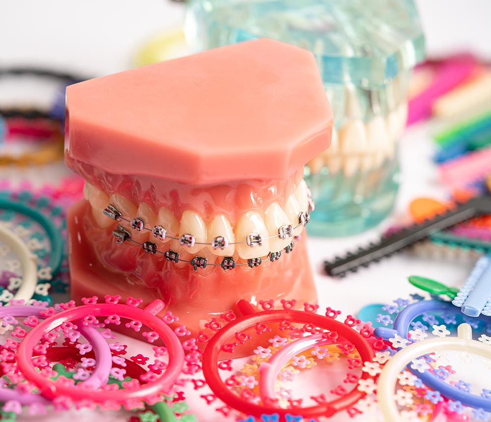 New Patients Welcome - Harmony Smiles Orthodontics - Orthodontic Specialists Mississauga