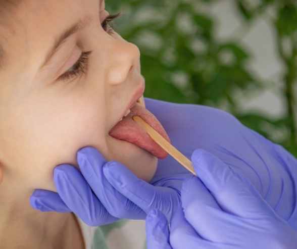 Tongue posture exercises